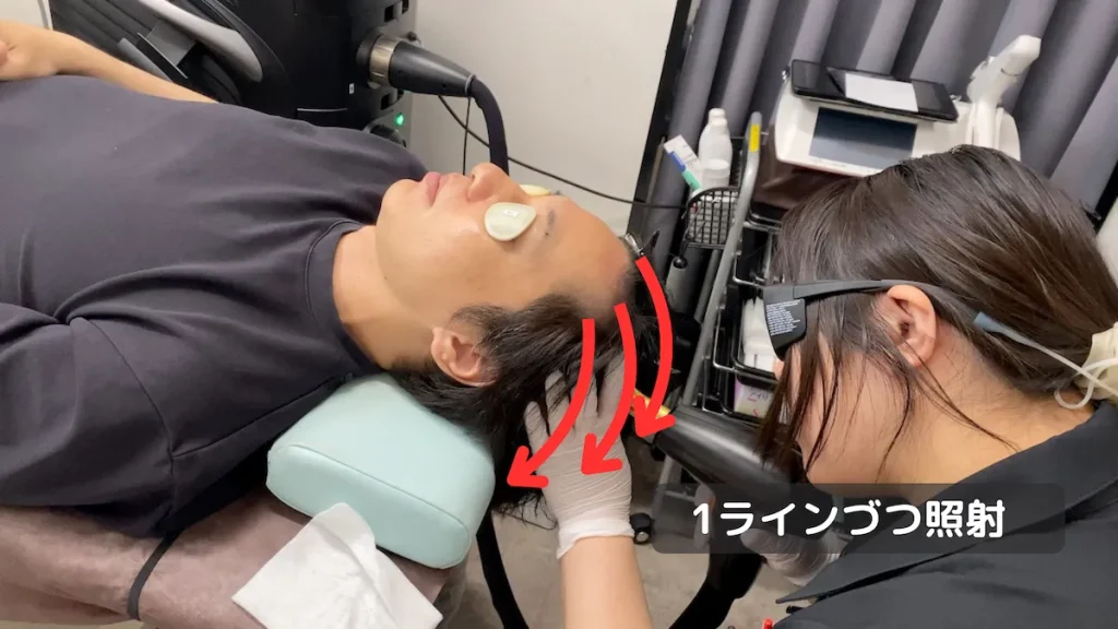 ラインに沿って照射